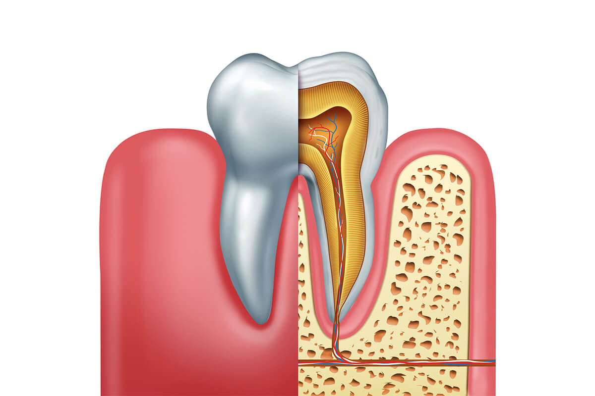 How Do You Know If You Need A Root Canal? Aurora, OH